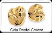 Dental Crown - all Gold Restorations