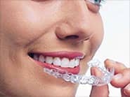 Invisalign clear braces