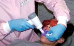 Oral Cancer Screening with VELscope Vx