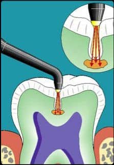 Chandler High Tech Dentistry