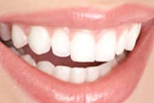 Chandler Dentist - Periodontal Dentistry