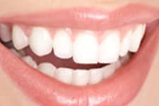 Periodontal Care in Chandler, AZ